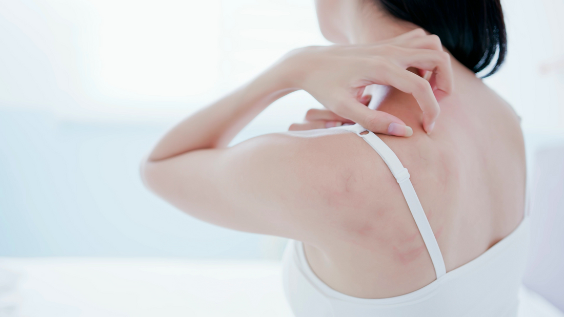 The Itchy Truth: 5 Tips on How to Stop Picking Your Skin